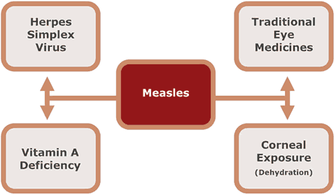 Measles and Corneal Ulceration