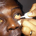 Como aplicar a pomada oftalmológica