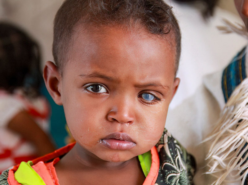 A close up image of a child's face