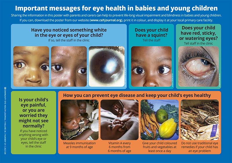 Community Eye Health Journal » Important messages for eye health in babies  and young children