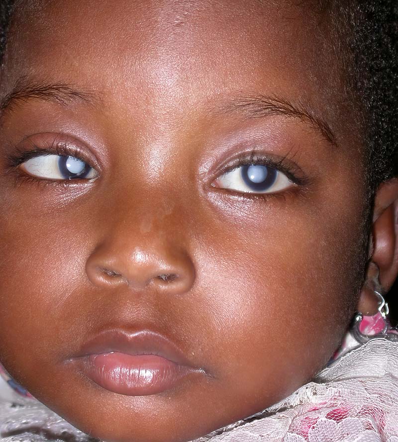 Close up image of a child's face